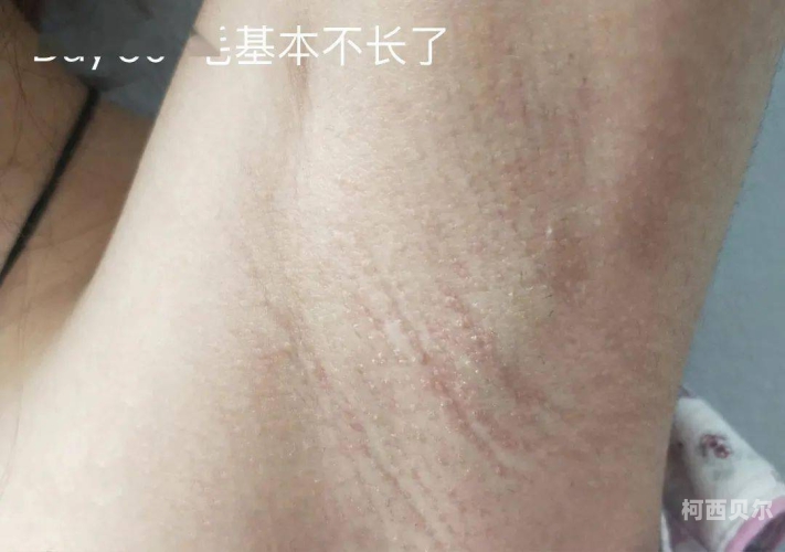 女人毛毛扒开自慰女人毛毛扒开自慰，揭秘背后的心理与文化现象